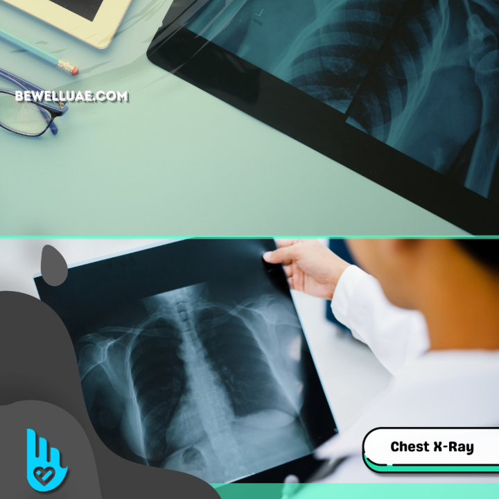 X-RAY Single View (Healthcare City)